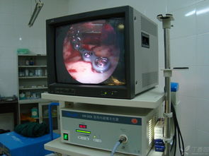 專利產(chǎn)品 內(nèi)窺鏡輔助新型穿頰器在頜面骨骨折內(nèi)固定中的應(yīng)用及計(jì)算機(jī)軟硬件輔助系統(tǒng)集成